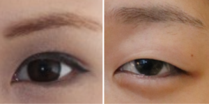 一重と二重
